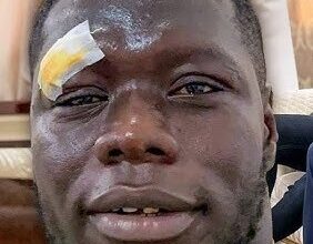 Première réaction de Franc, après sa victoire